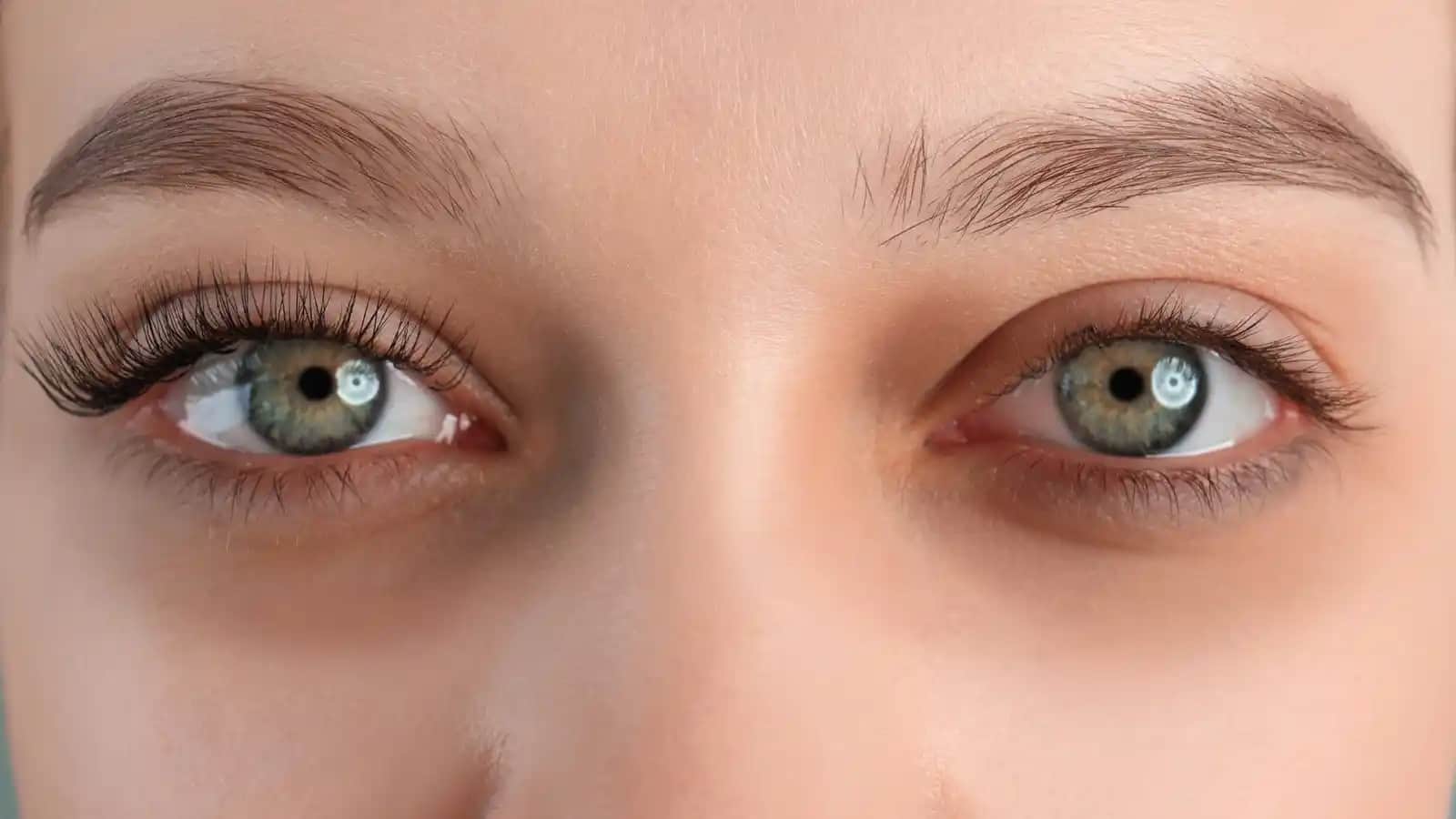 Göz Altı Morlukları Nasıl Geçer En Etkili Çözüm Yöntemleri ve Bakım İpuçları