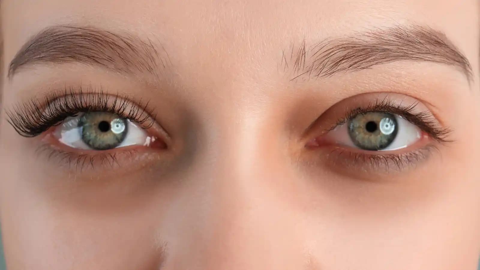 Göz Altı Morlukları Nasıl Geçer En Etkili Çözüm Yöntemleri ve Bakım İpuçları