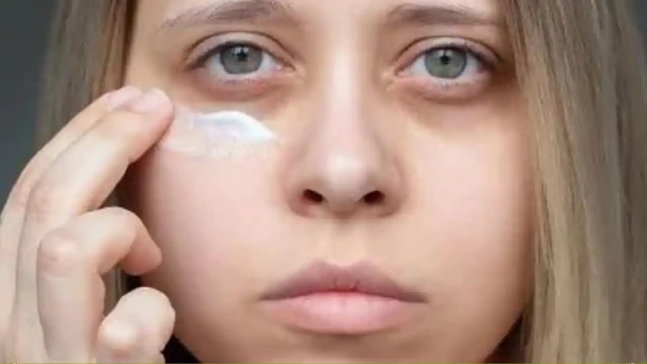 Göz Altı Morluklarına Karşı Etkili Çözüm Yolları ve Doğal Yöntemler