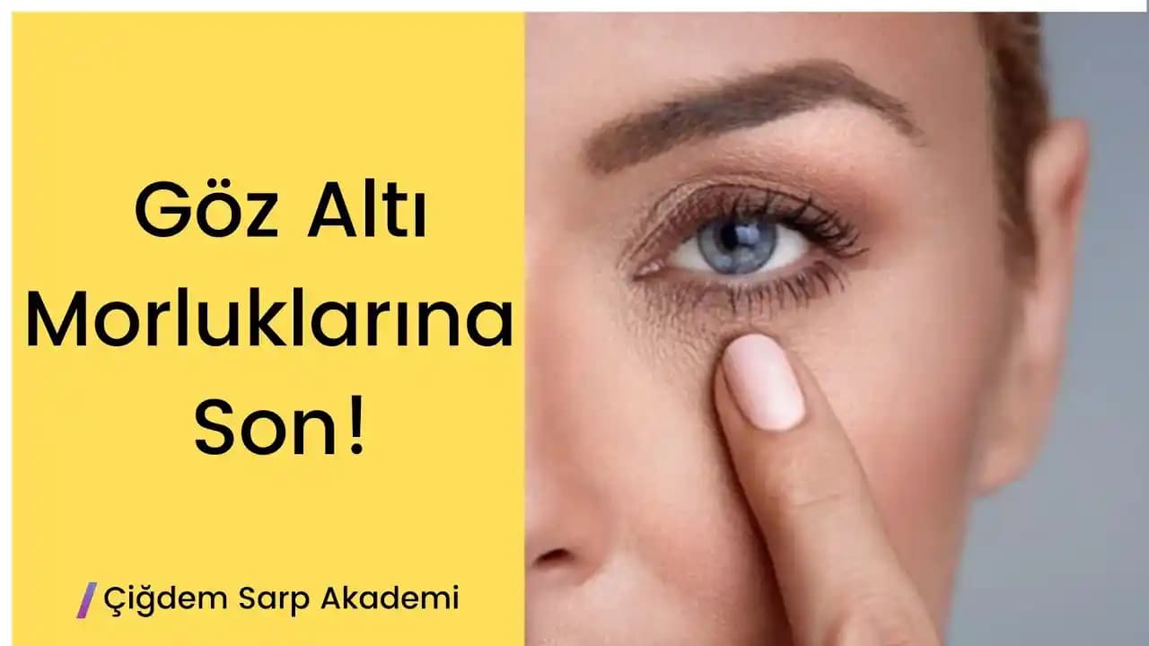 Göz Altı Morluklarını Azaltmanın Etkili Yolları ve Uygun Tedavi Seçenekleri