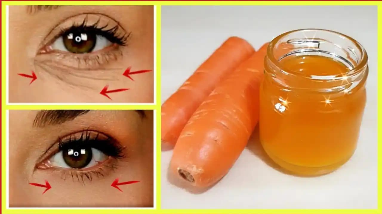 Göz Çevresi Kırışıklıklarını Azaltmak İçin Etkili Yöntemler ve Bakım Tüyoları