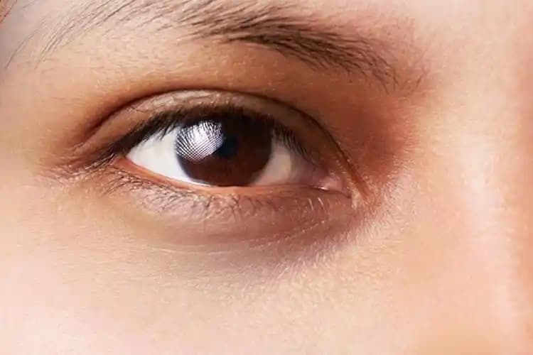 Göz Kapağı Kararması Nedenleri ve Etkili Çözüm Yöntemleri Hakkında Bilgilendirici Rehber