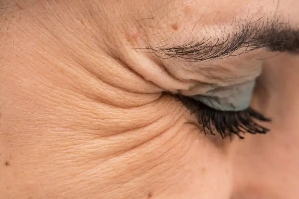 Göz Kazayağıları Nedir, Neden Oluşur ve Göz Çevresi Bakım Yöntemleri