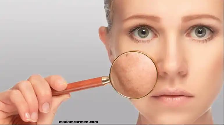 Gözenekleri Sıkılaştırma Yöntemleri ve Cilt Sağlığı İçin En Etkili İpuçları