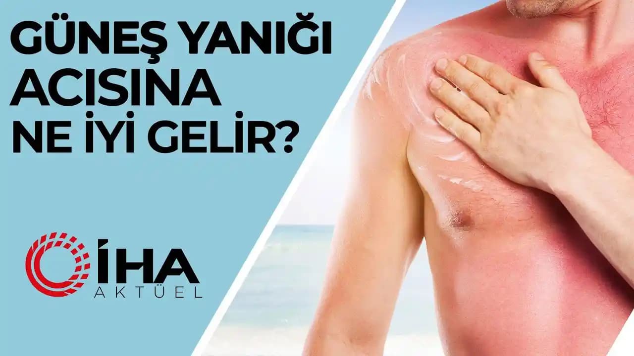 Güneş Yanığına Karşı Doğal ve Kozmetik Çözümlerle Cilt Bakımı Rehberi