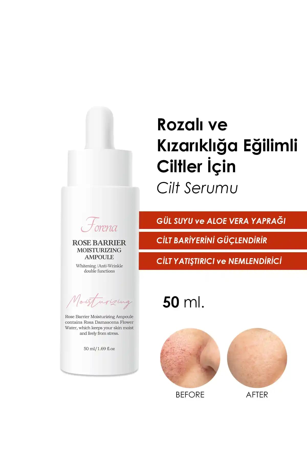 Hafif Rozalı Cilt Bakımı: Doğru Ürünler ve Uygulamalarla Sağlıklı Görünüm