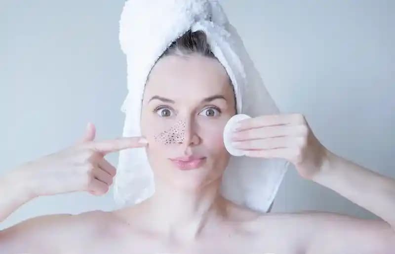 Hamilelikte Siyah Nokta Temizliği: Güvenli ve Doğal Yaklaşımlar ile Cilt Bakımı