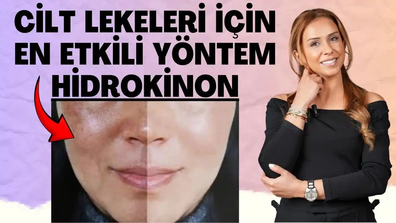 Hidrokinon ile Ciltte Gözle Görülen Değişimler ve Güvenlik İpuçları