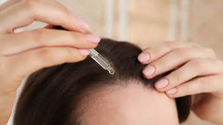 Kafa Derisindeki Egzamaya Karşı Etkili Yöntemler ve Doğal Çözüm Tavsiyeleri