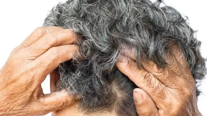 Kafa Kaşıntısının Nedenleri ve Saç Derisi Sağlığı İçin Bilinmesi Gerekenler