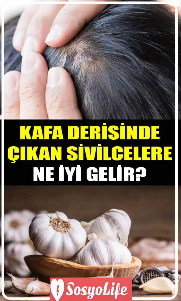Kafa Yaralarına Ne İyi Gelir Güvenli ve Etkili Yöntemler Hakkında Kapsamlı Bilgiler