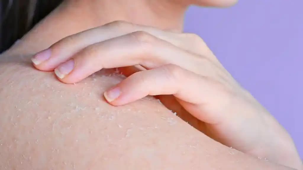 Kafadaki ölü deriyi temizleme yöntemleri ve cilt sağlığı için pratik bilgiler