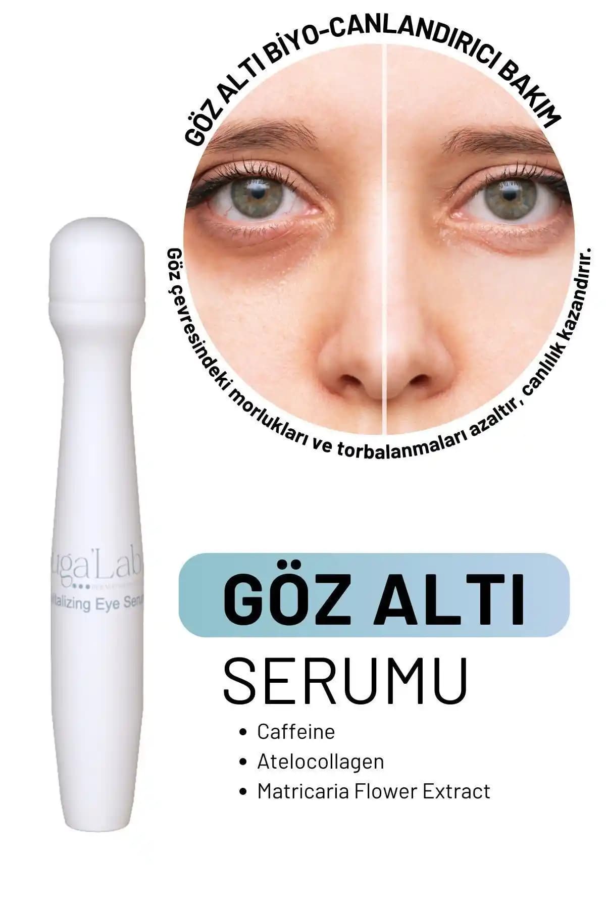 Kafein ve Göz Altı Morlukları: Etkili Kullanım Yolları ve Cilt Sağlığı İpuçları