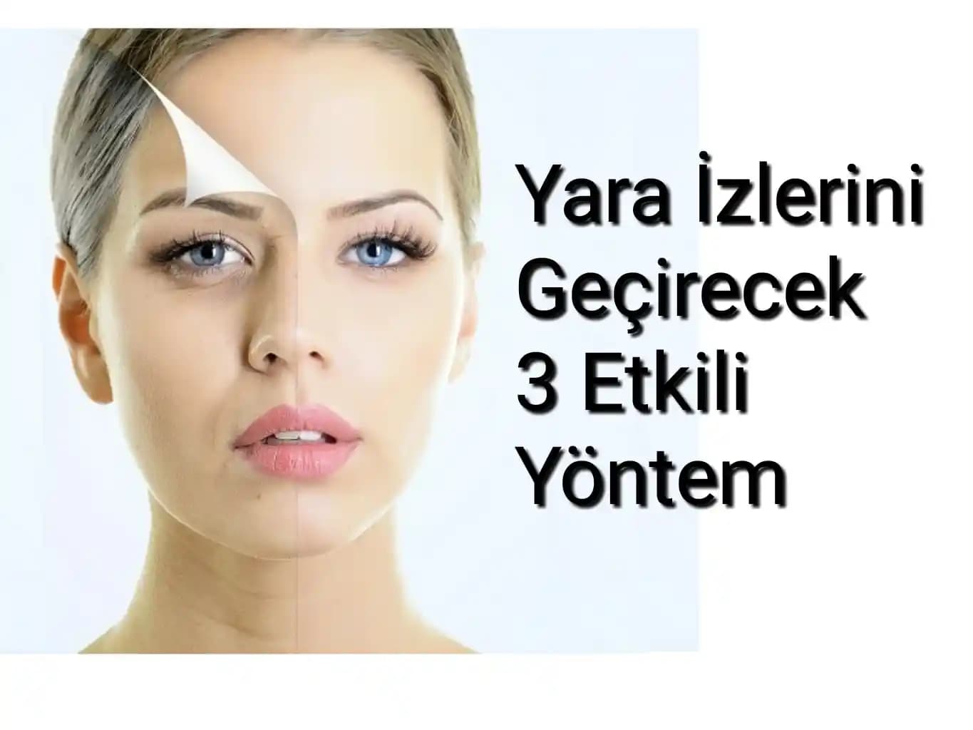 Kahverengi Yara İzleri Nasıl Azaltılır ve Ciltteki Görünümünü Nasıl Geliştirir