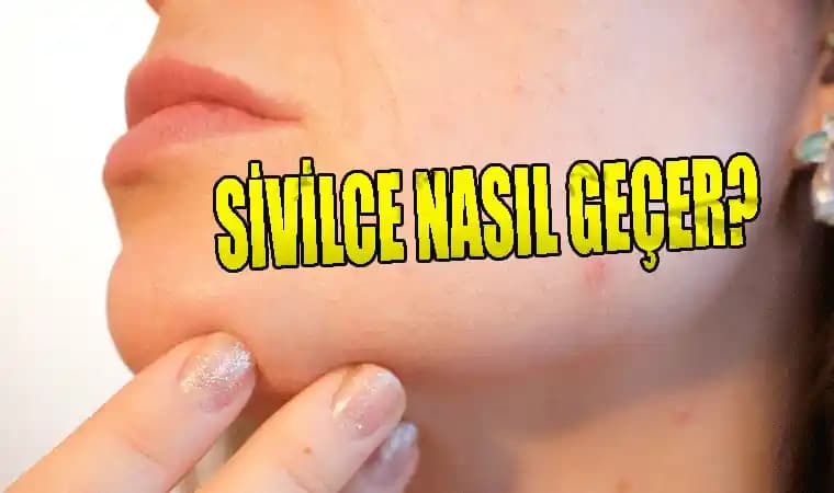Kalça Sivilce Lekeleri Nasıl Geçer: Etkili Tedavi Yöntemleri ve Doğal Çözümler
