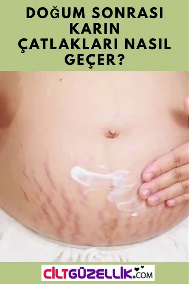 Kalçada Çatlak Nasıl Geçer Etkili ve Güncel Yöntemler Hakkında Kapsamlı Rehber