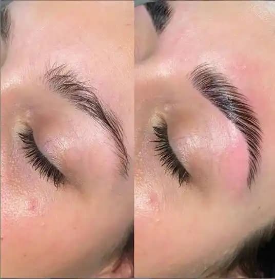 Kaş Laminasyonu Nedir ve Doğal Güzelliğinizi Ön Planda Tutmanın Yolları