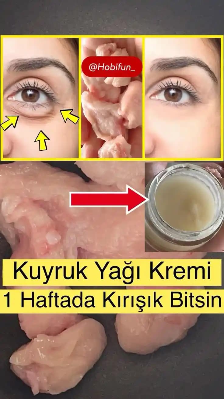 Kirişlik İçin Doğal Çözüm Yolları Güzellik ve Sağlığınızı Korumanın Etkili Yolları