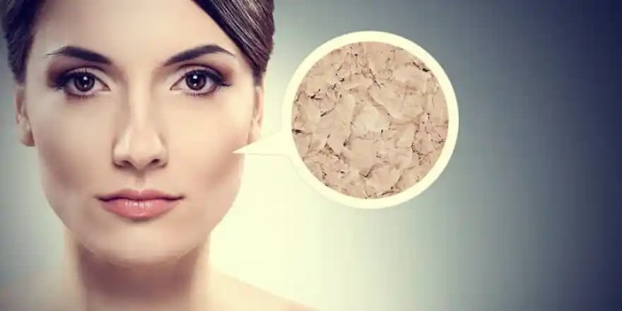 Kış Aylarında Yüz Kuruluğunu Önlemek İçin Etkili Bakım Yöntemleri ve Tavsiyeler