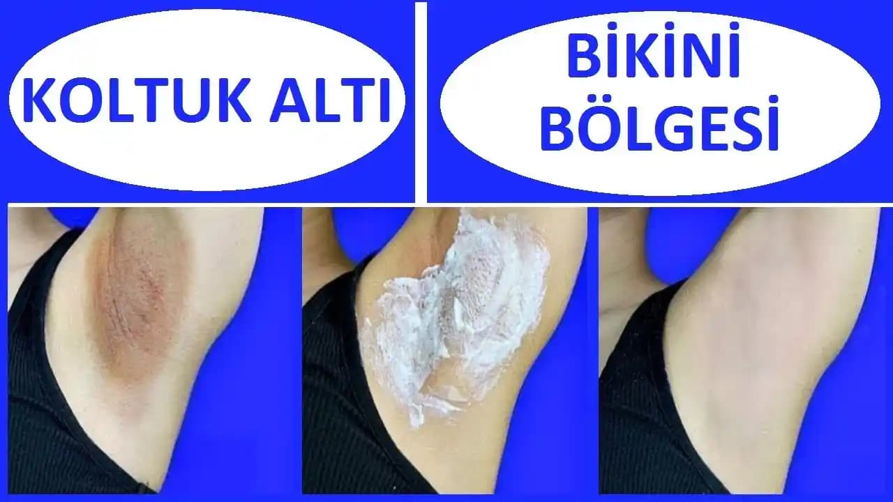 Kol Beyazlatma Yöntemleri ve Doğru Uygulamalar Hakkında Kapsamlı Rehber