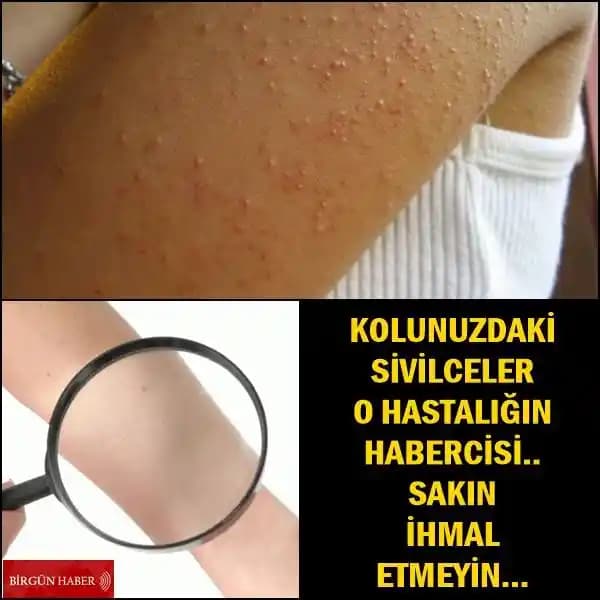 Kolda Yara Çıkması: Nedenleri, Belirtileri ve Etkili Çözüm Yöntemleri Hakkında Bilgi