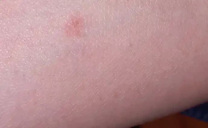 Kolda Yeşil Leke Sorunu ve Çözüm Yolları: Nedenleri ve Tedavi Yaklaşımları