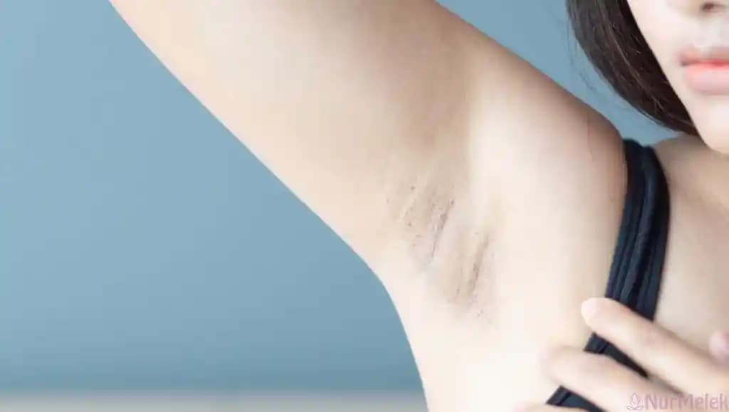 Koltuk Altı Kararmasını Azaltmak İçin AHA ve BHA Kullanım Rehberi