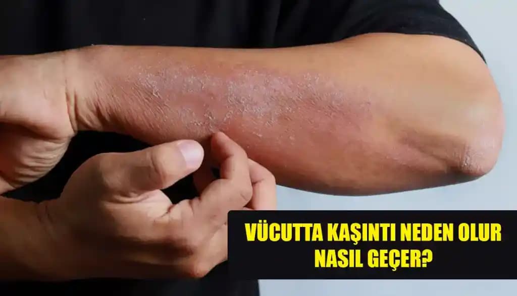 Kozmetik Ürünlerde Alerji Türleri ve Cilt Sağlığını Koruma Yöntemleri