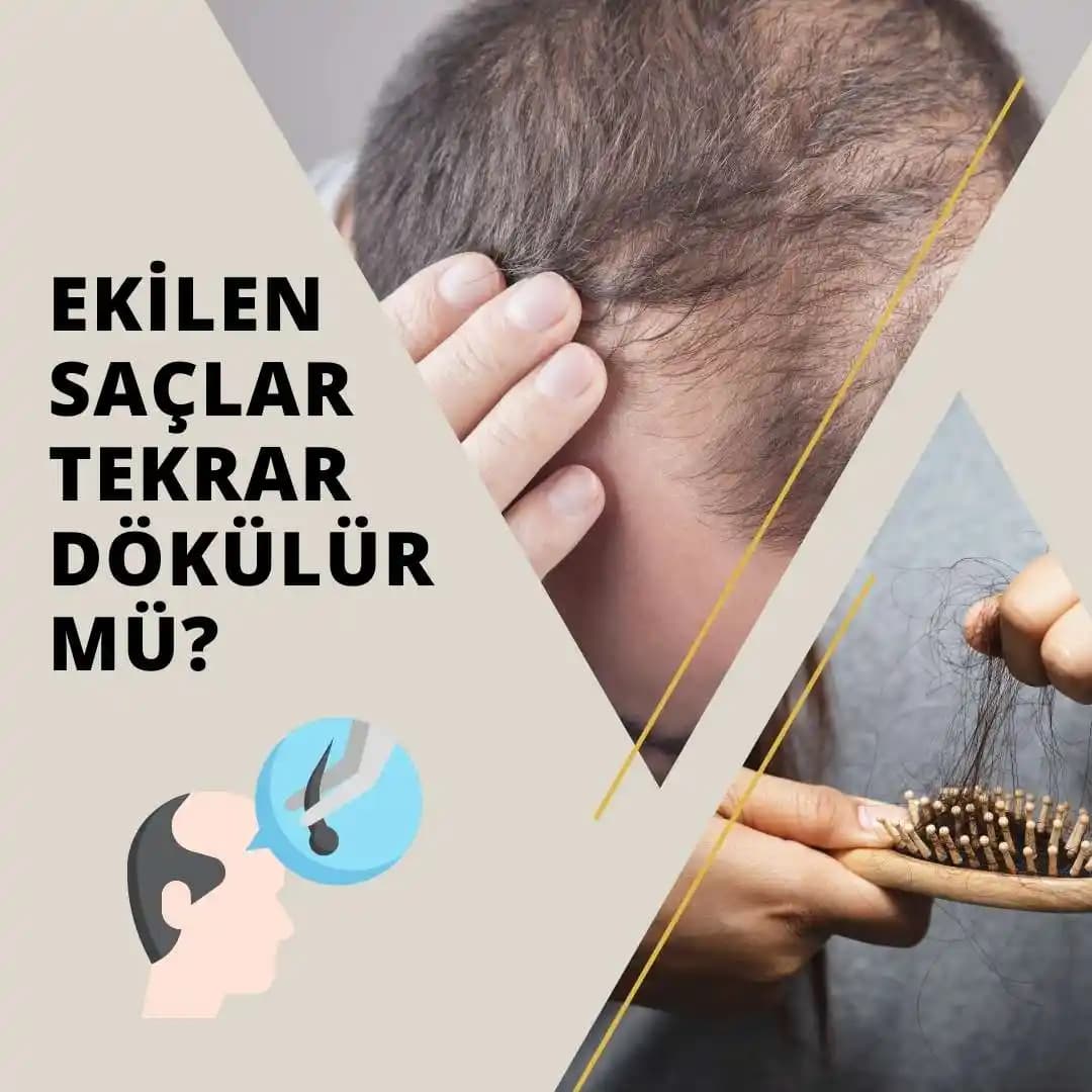 Kuru Saçların Dökülmesine Karşı Etkili Bakım ve Koruma Yöntemleri