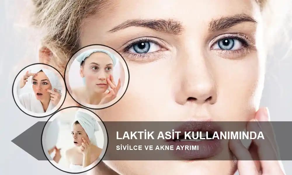 Laktik Asidin Cilt Bakımındaki Rolü ve Güvenli Kullanım İpuçları