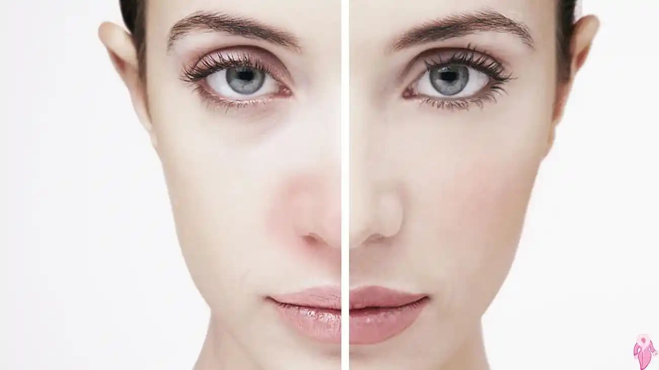 Makyaj Alerjisi Nedir Nasıl Korunuruz Güvenli Makyaj Uygulamaları Rehberi