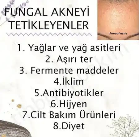 Mantar Enfeksiyonu ve Fungal Akne: Evde Tedavi Yöntemleri ve Cilt Sağlığı İpuçları