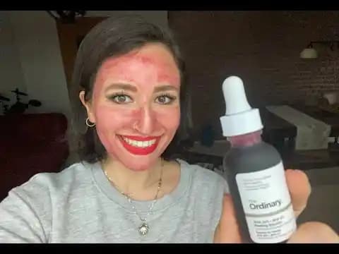 Ordinary Kırmızı Peeling ile Cilt Yenileme ve Güzellik İçin Güncel Yaklaşımlar