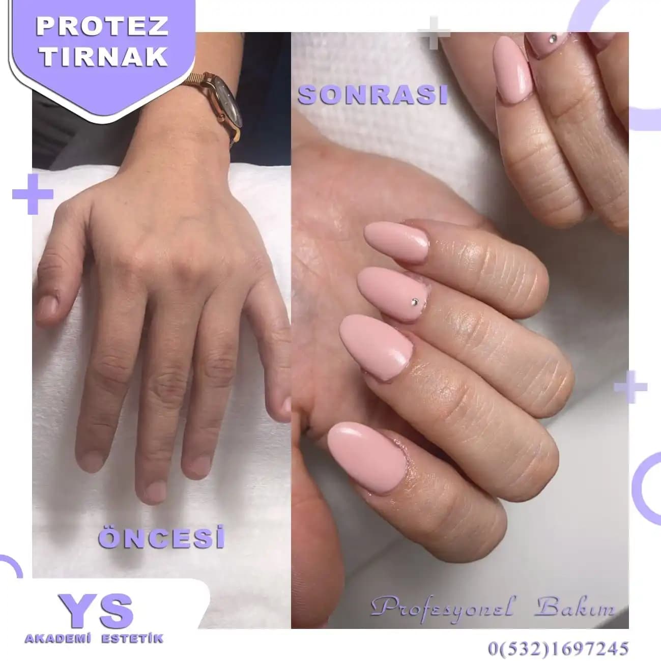 Ortadan Kırılan Tırnaklar İçin Etkili Çözüm Yolları ve Sağlıklı Tırnaklara Ulaşma Rehberi