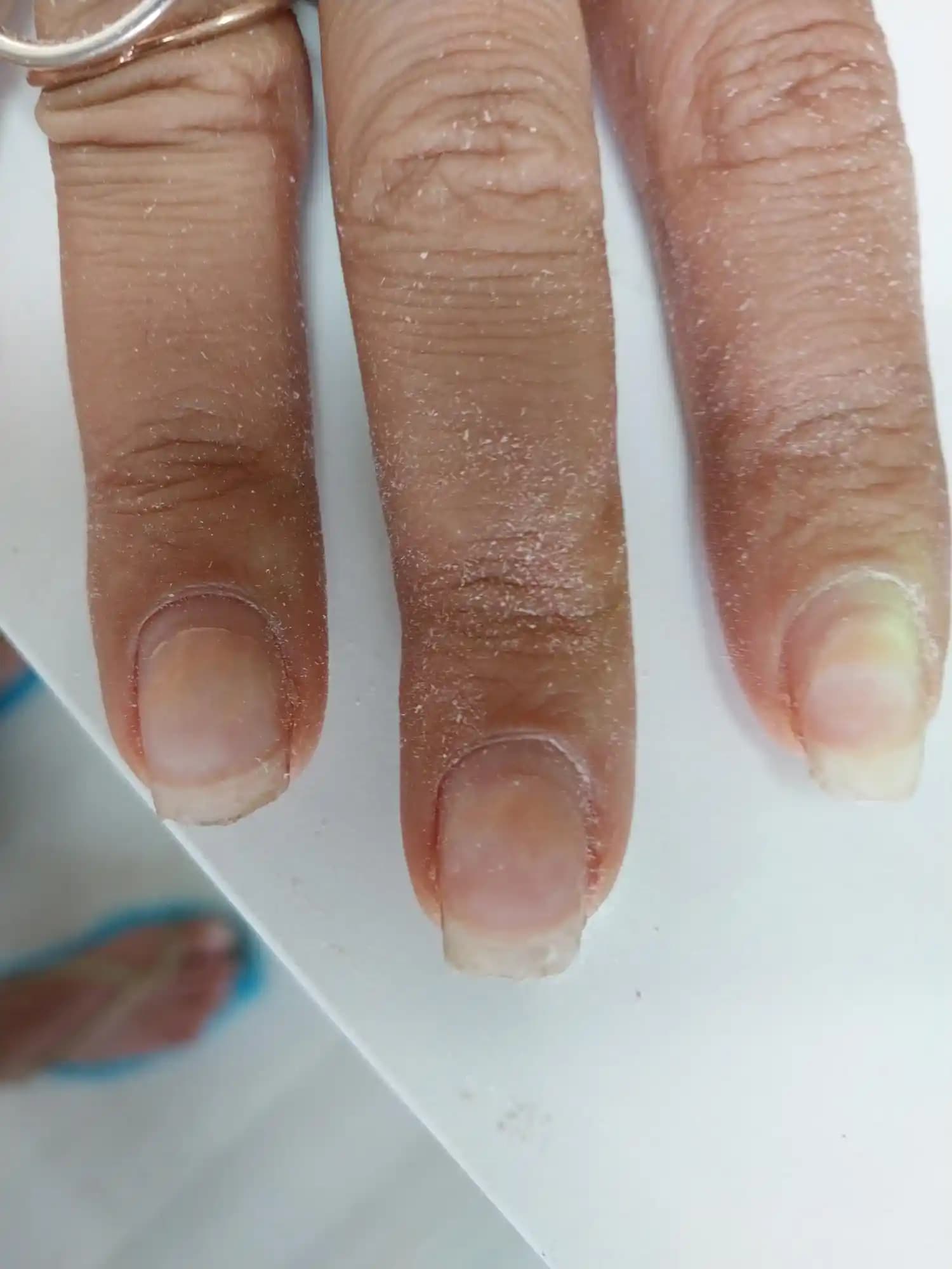 Protez Tırnak Kullanımında Mantar Riskleri ve Sağlıklı Bakım Yöntemleri