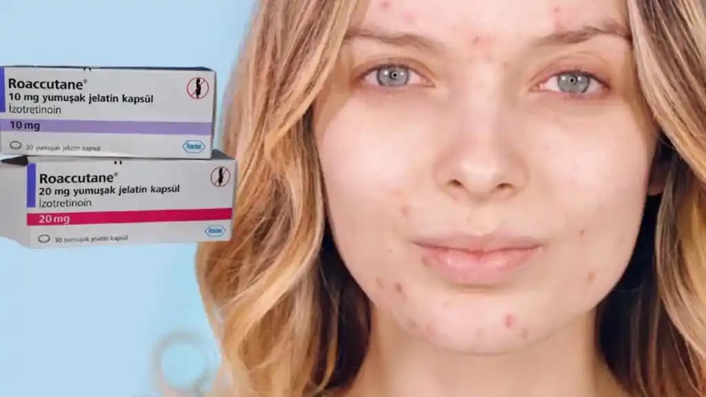 Roaccutane Kremi Nedir, Nasıl Kullanılır ve Kozmetik Ürünlerle Uyum Sağlar mı