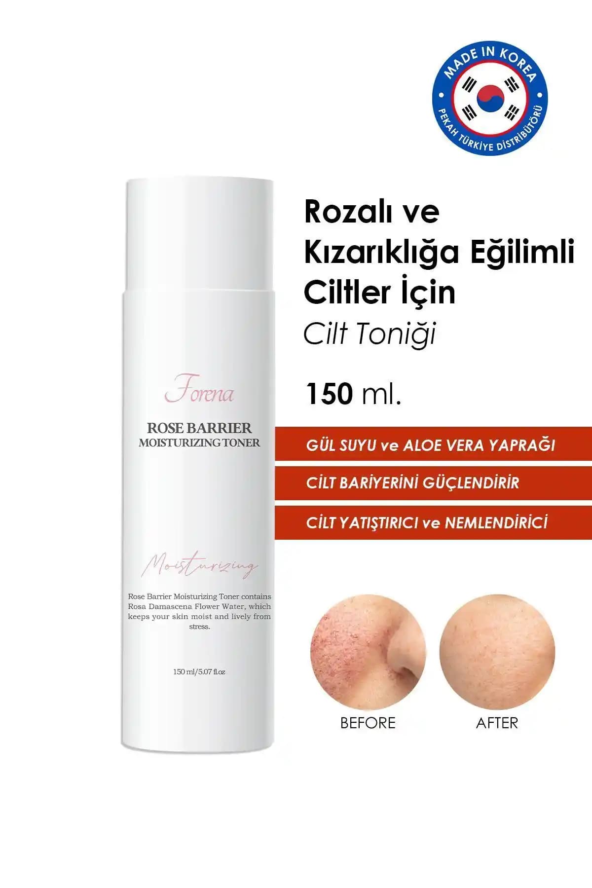 Rozalı Ciltler İçin En İyi Tonik Rehberi ve Doğal Tarifler