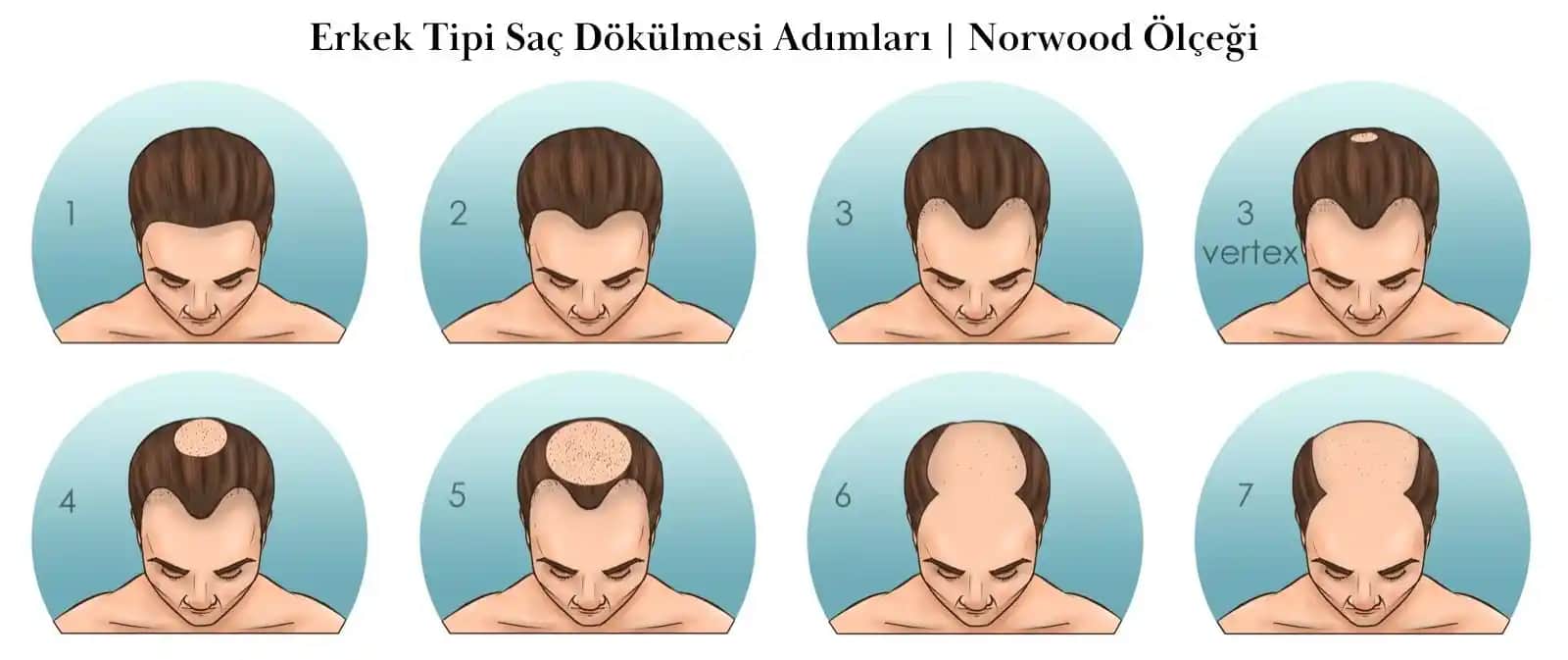 Saç Derisi Dökülmesinin Nedenleri ve Etkili Çözüm Yolları Hakkında Bilgiler