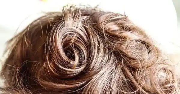 Saç Derisinin Ağrıması: Nedenleri, Belirtileri ve Etkili Önlemler