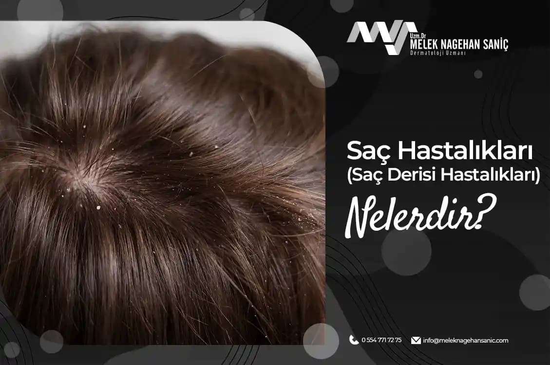 Saç Derisinin Kaşınma Sebepleri ve Koruyucu Bakım Yöntemleri