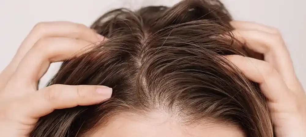 Saç Dibi Yağlanması Nedenleri ve Etkili Bakım Yöntemleri Hakkında Bilgiler