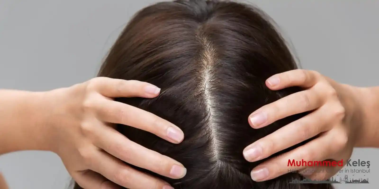 Saç Diplerindeki Ağrı ve Rahatsızlık Nedenleri ile Etkili Çözüm Yöntemleri