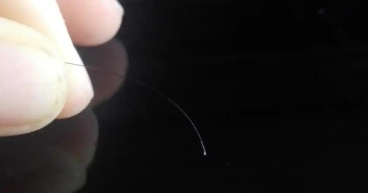 Saç Kökündeki Beyaz Noktalar ve Nedenleri Hakkında Kapsamlı Bilgi