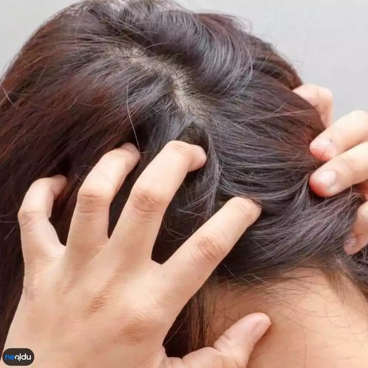 Saç Yağlanması ve Kaşıntı Nedenleri ile Saç Sağlığını Koruma Yöntemleri