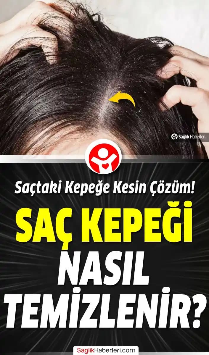 Saç Yaraları Nasıl Geçer? Doğru Yöntemler ve İpuçlarıyla Sağlıklı Saçlara Ulaşın