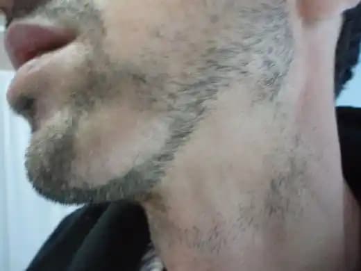 Saçkıran ve Sakal Sağlığı İçin Kozmetik ve Doğal Çözüm Yaklaşımları