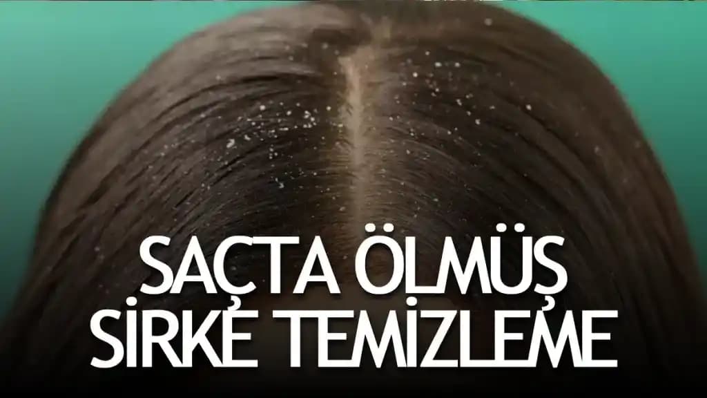 Saçta Ölmüş Sirke Uygulaması ve Doğal Saç Bakımında Doğru Kullanım Yöntemleri