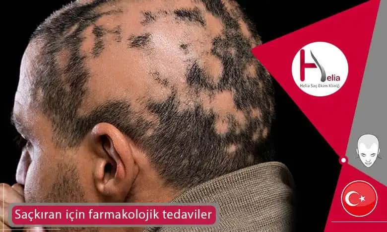 Sakal Kıranını Önleme ve Tedavi Yöntemleri Doğal ve Kozmetik Yaklaşımlar