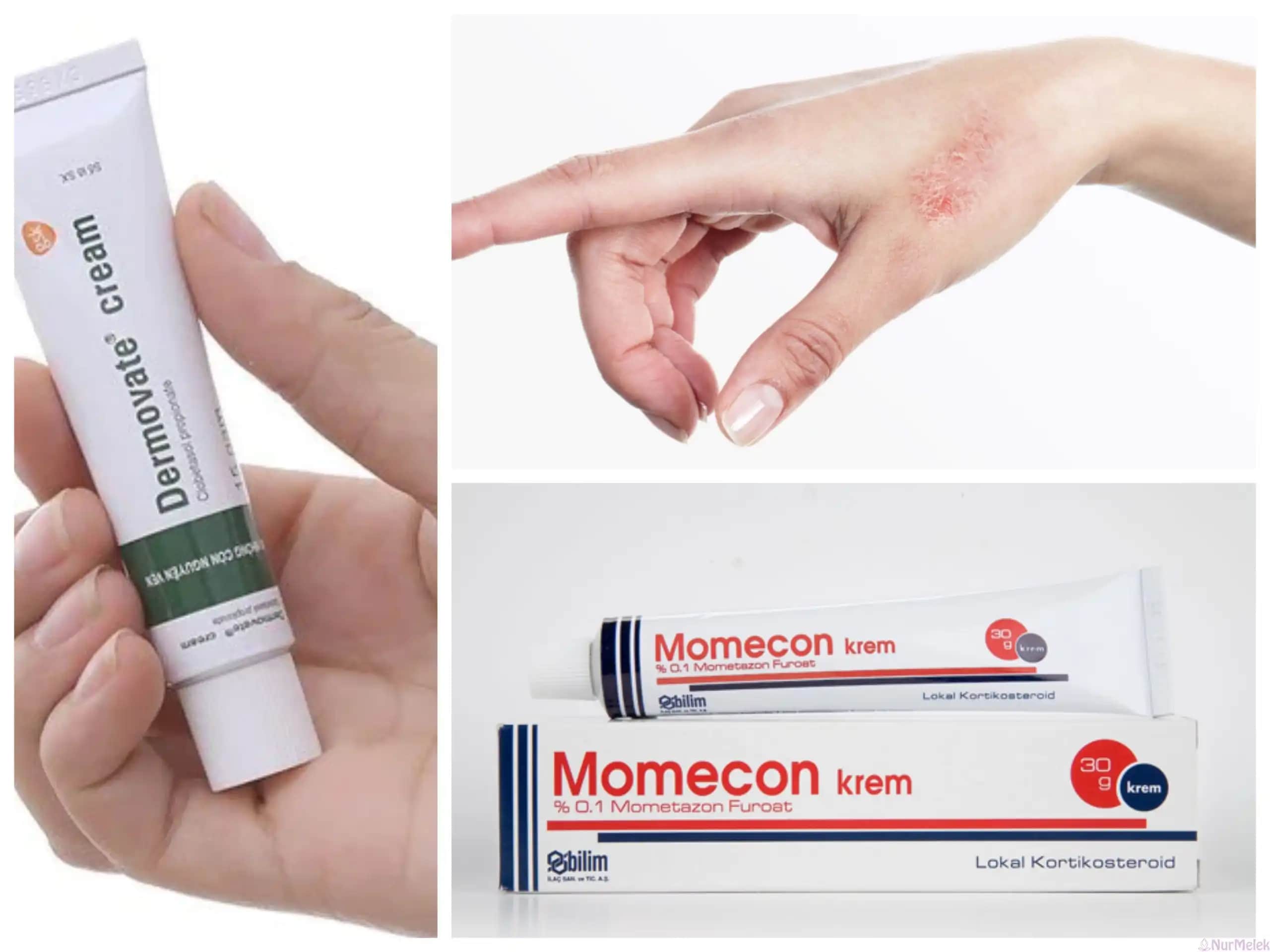 Sedef Hastalığında Krem Seçimi ve Cilt Sağlığını Koruma Yolları