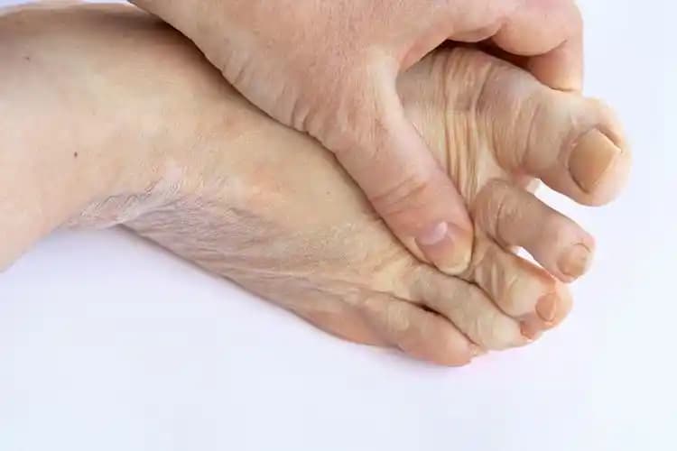 Sedef Hastalığını Tetikleyen Faktörler ve Cilt Sağlığına Etkileri